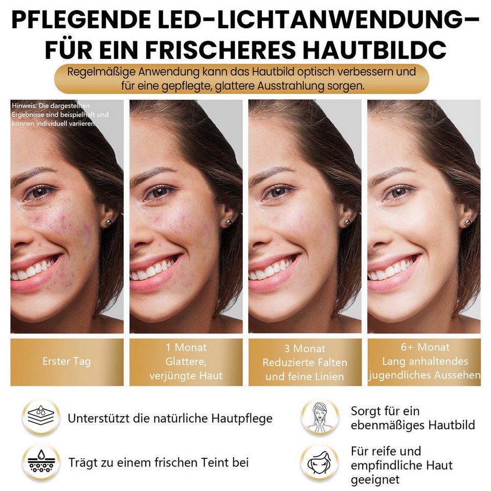 FOSMET 7 Farben LED Gesichtsmaske