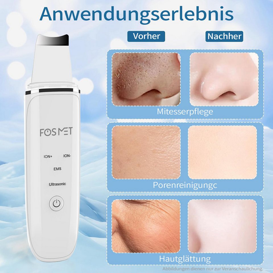 FOSMET Porenreiniger Ultraschall Skin Scrubber