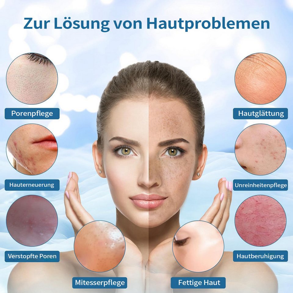 FOSMET Porenreiniger Ultraschall Skin Scrubber